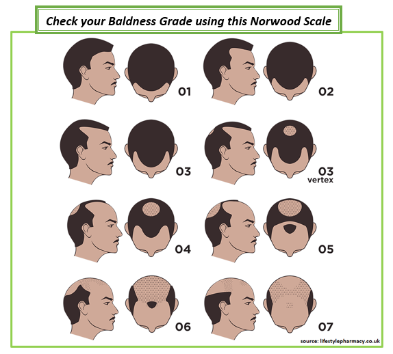 Baldness grade