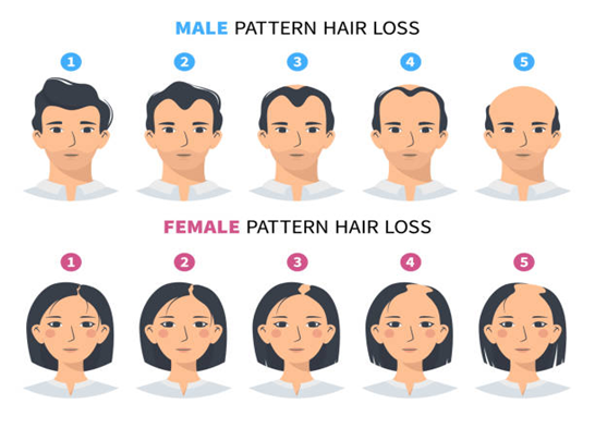hair thinning male vs female