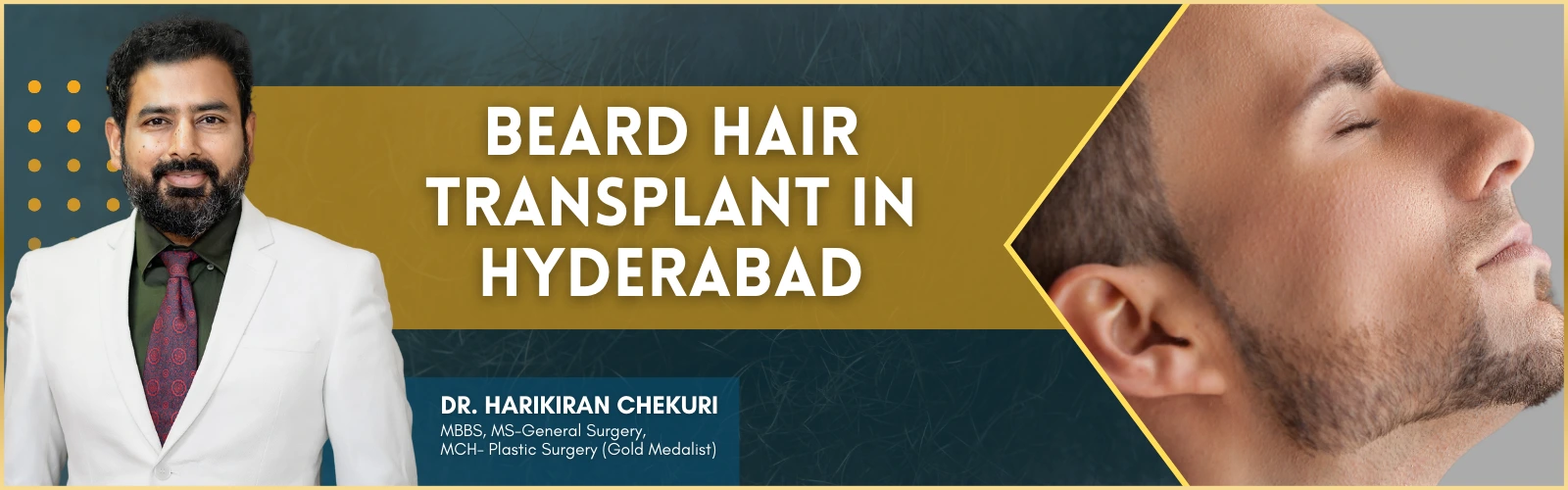 Beard Hair Transplant In Hyderabad