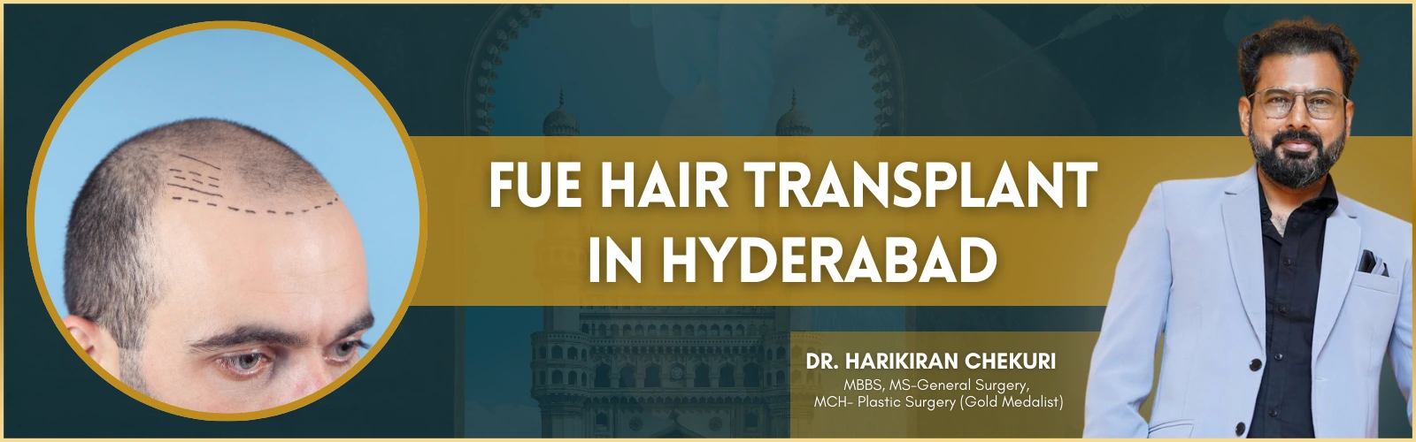 FUE Hair Transplant in Hyderabad