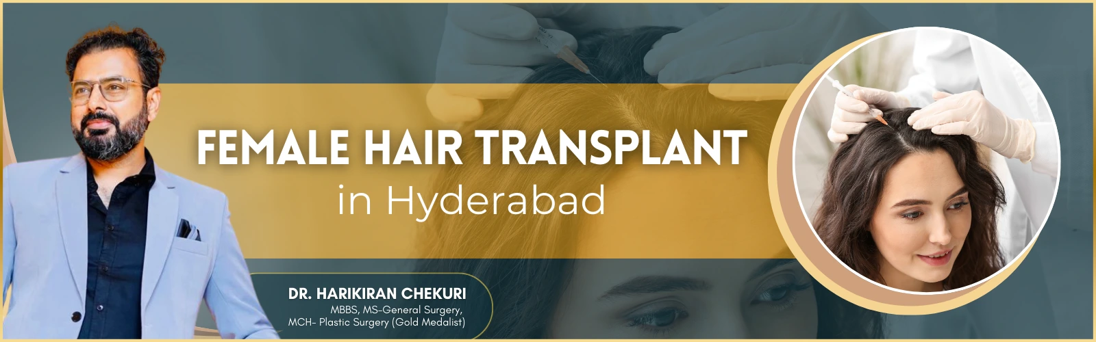 Female Hair Transplant in Hyderabad