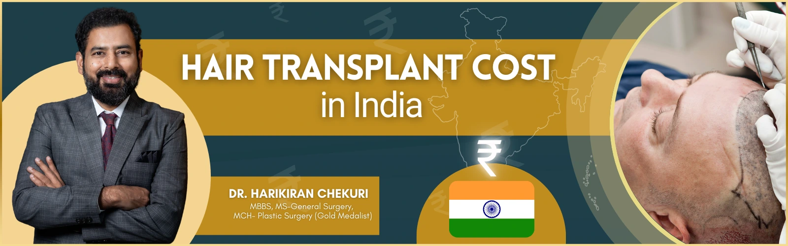 Hair Transplant Cost in India