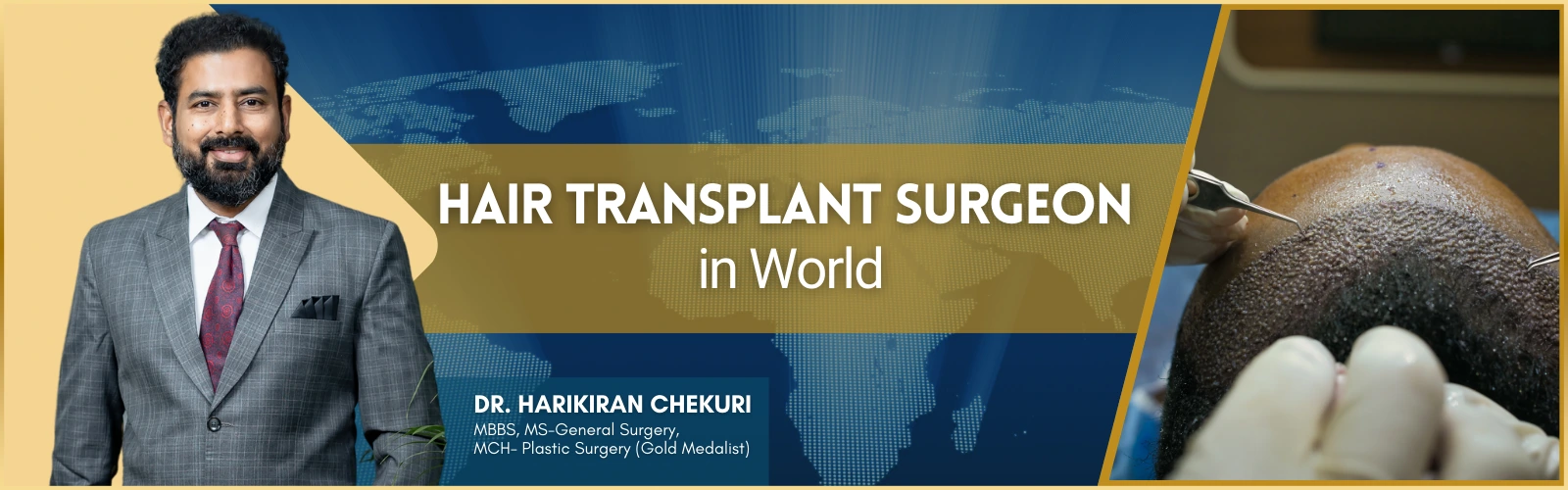 Hair Transplant Surgeon in World