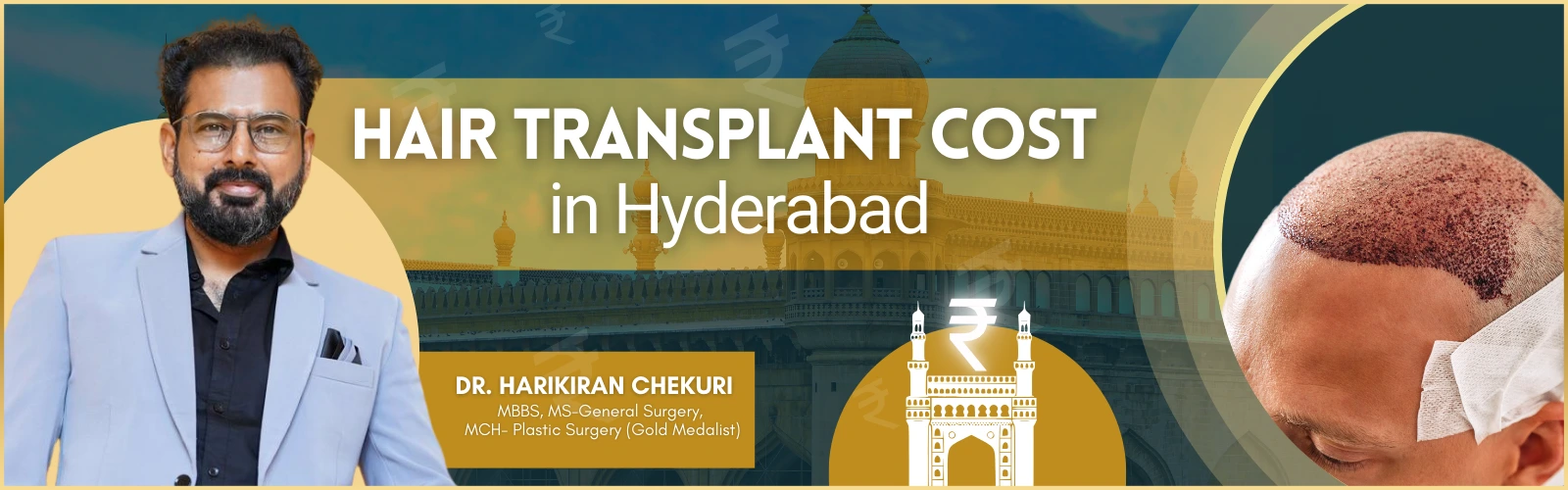 Hair transplant cost in Hyderabad