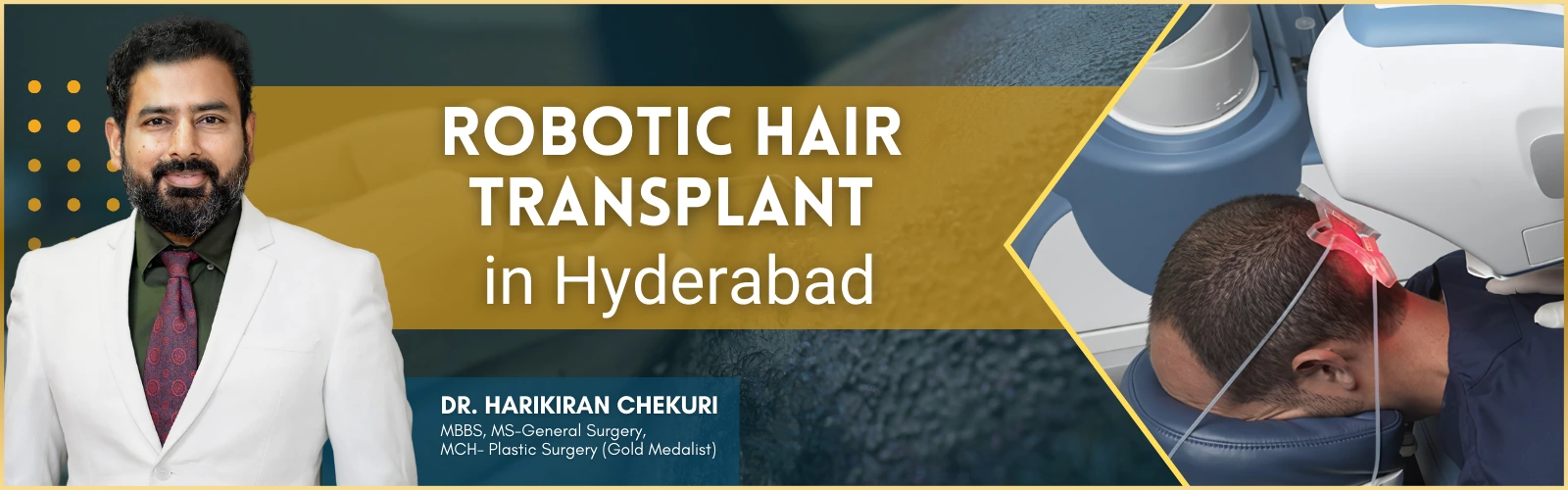 Robotic Hair Transplant in Hyderabad