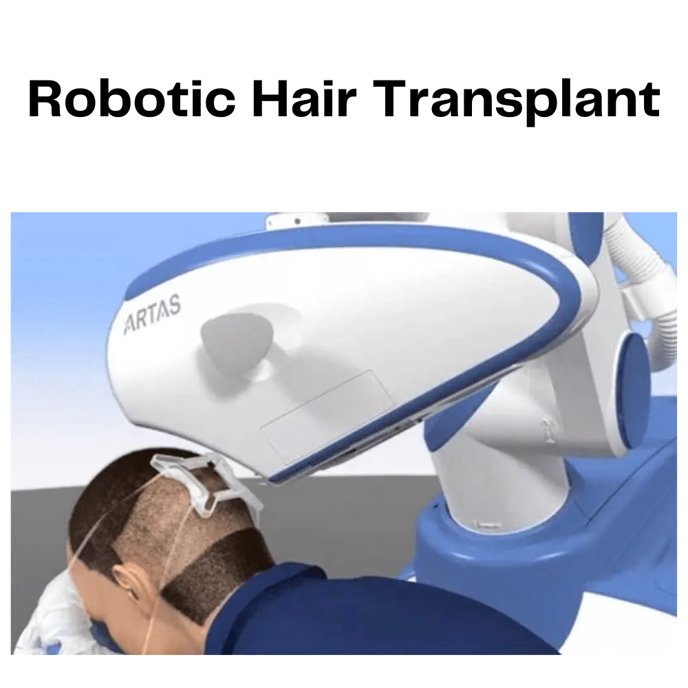 Robotic Hair Transplant