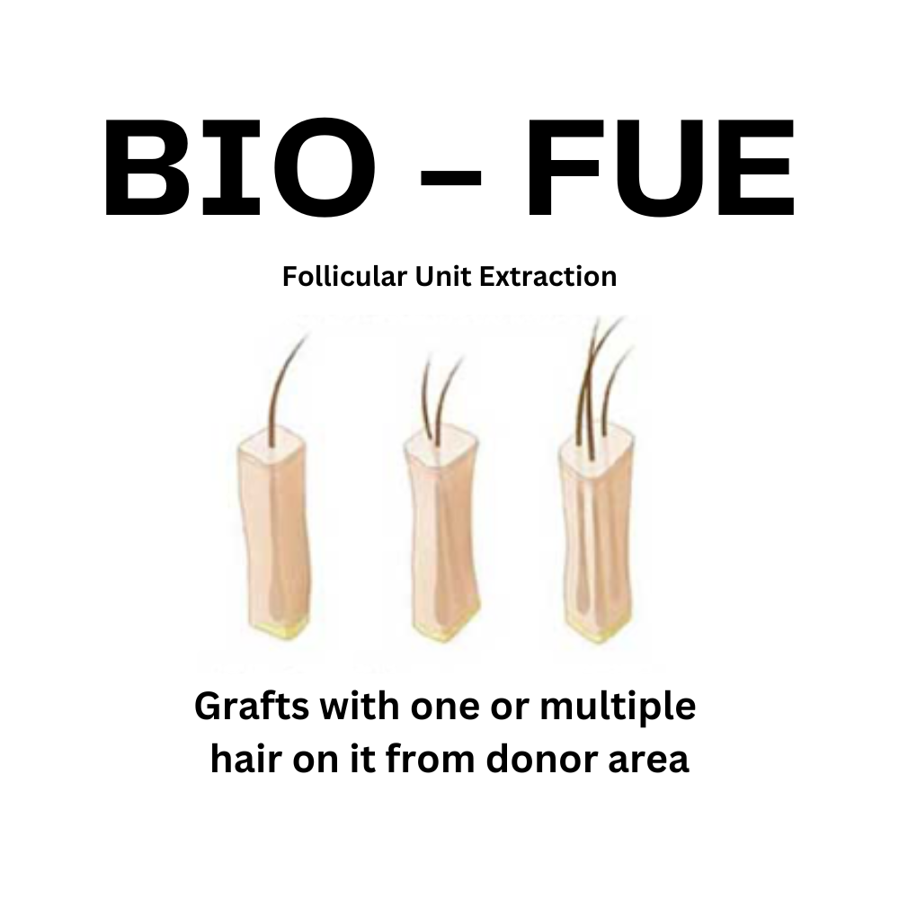 Bio-FUE Hair Transplant