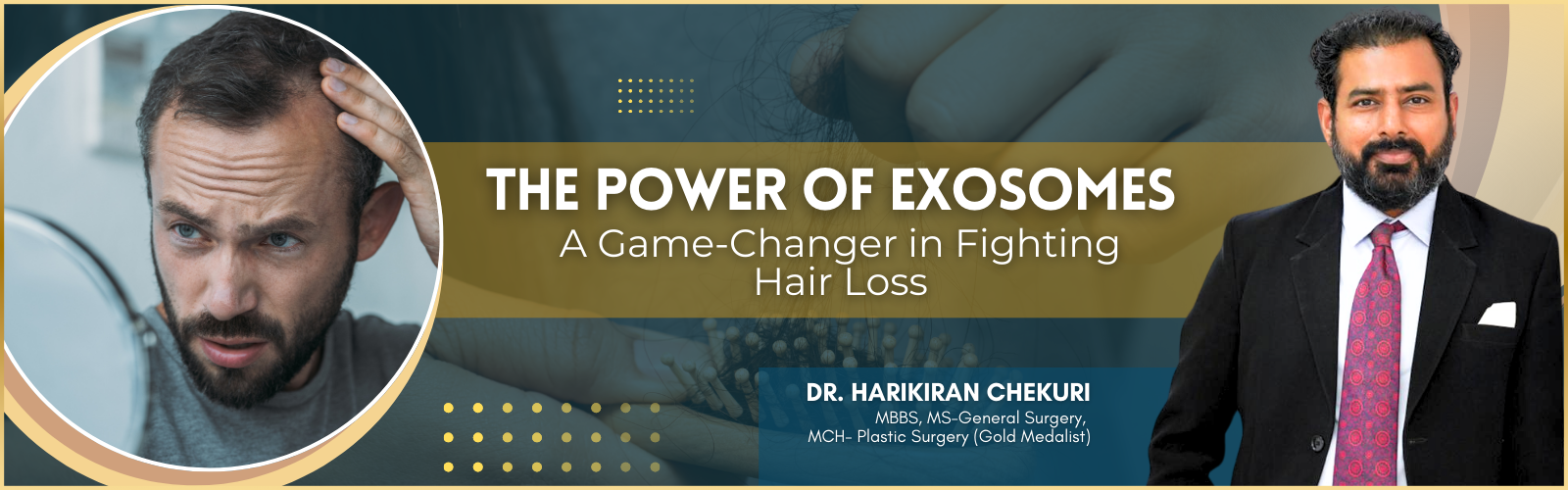 Exosomes for hair loss in Hyderabad