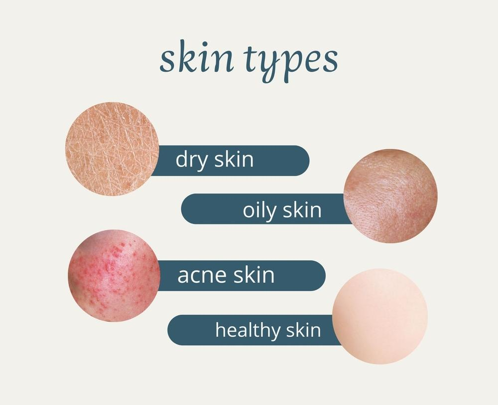 Skin-types