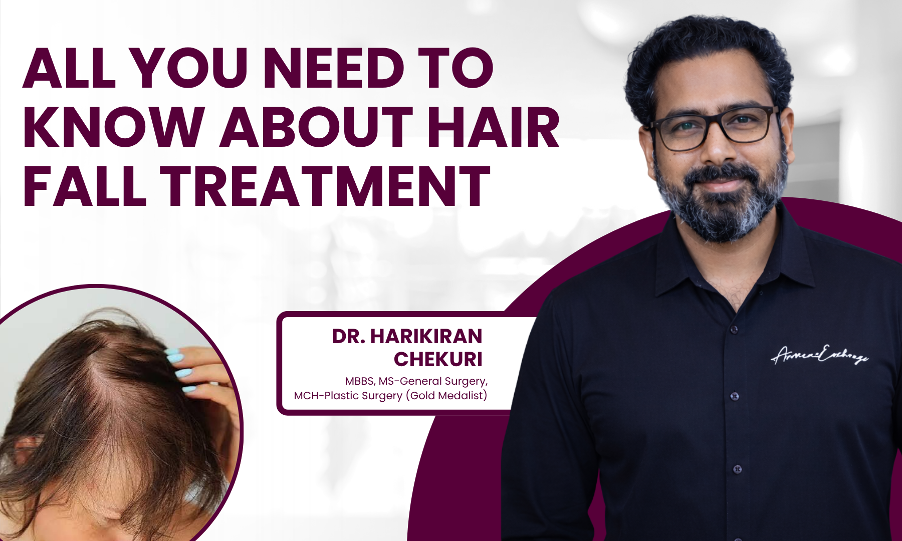 All You Need to Know About Hair Fall Treatment