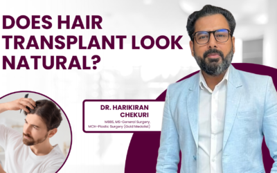 Does Hair Transplant Look Natural?