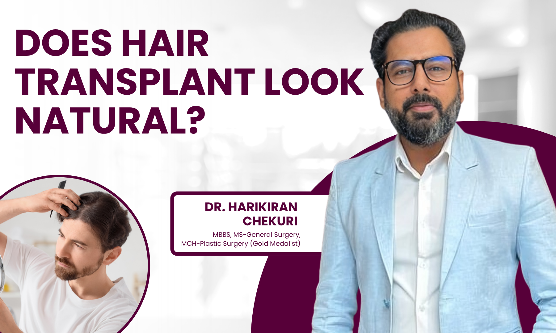 Does Hair Transplant Look Natural