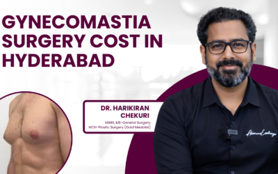 How much does Gynecomastia Surgery cost in Hyderabad?