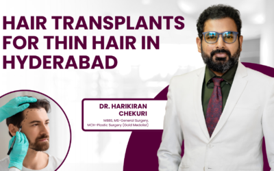 Do hair transplants in Hyderabad work for thin hair?