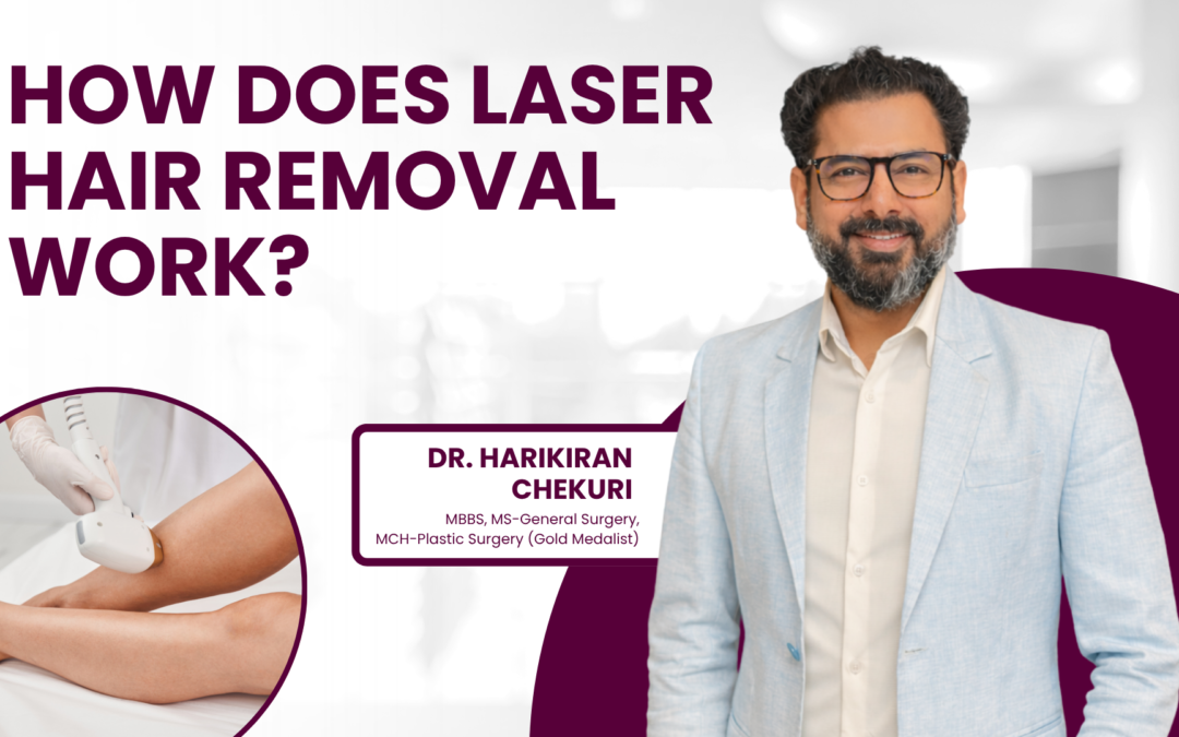 How Laser Hair Removal Works?