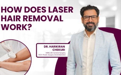 How Laser Hair Removal Works?