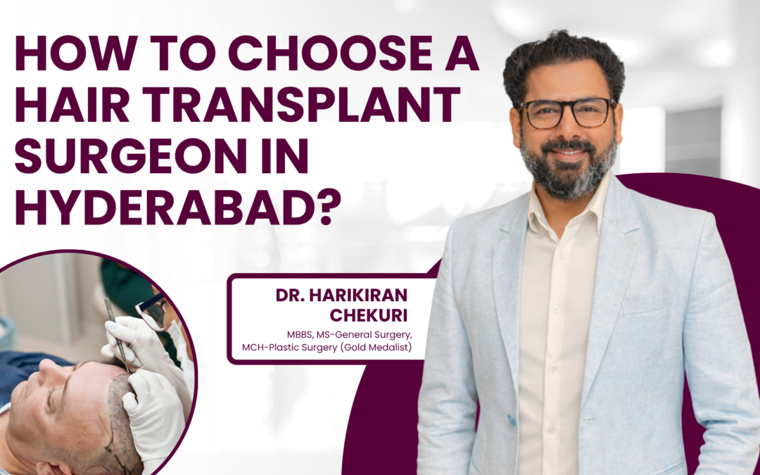 How to Choose a Hair Transplant Surgeon in Hyderabad?