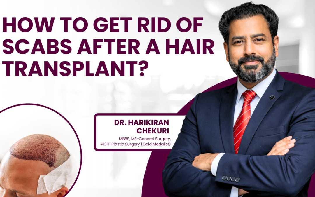 How to get rid of scabs after a hair transplant treatment?