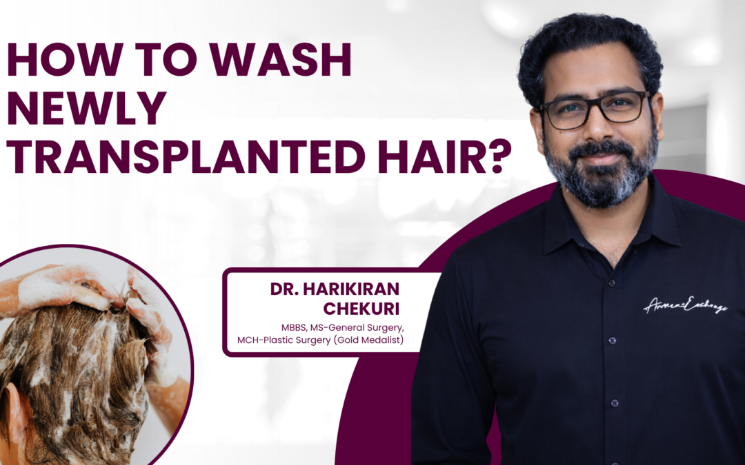 How to wash newly transplanted hair?