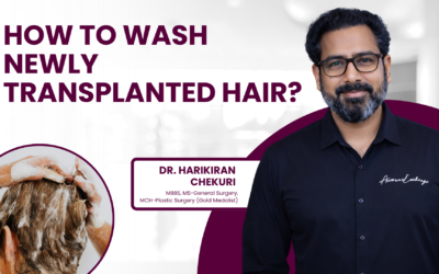 How to wash newly transplanted hair?