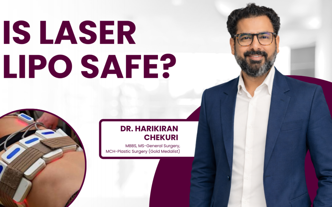 Is Laser Lipo Safe?