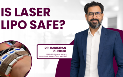 Is Laser Lipo Safe?