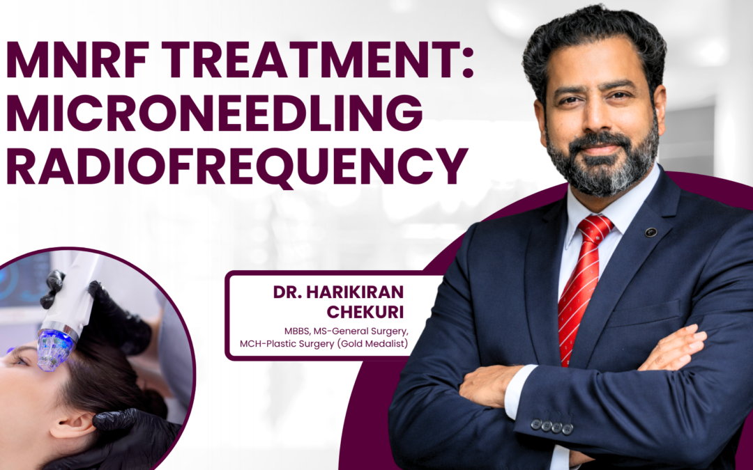 What is MNRF(Microneedling Radio frequency Treatment)?