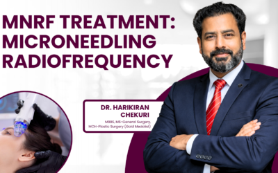 What is MNRF(Microneedling Radio frequency Treatment)?
