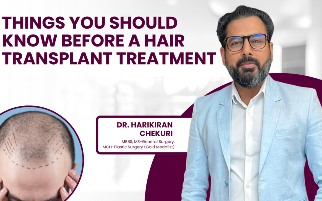 Things you should know before a hair transplant treatment