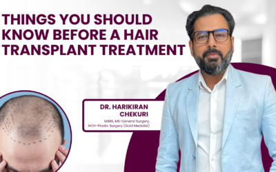 Things you should know before a hair transplant treatment