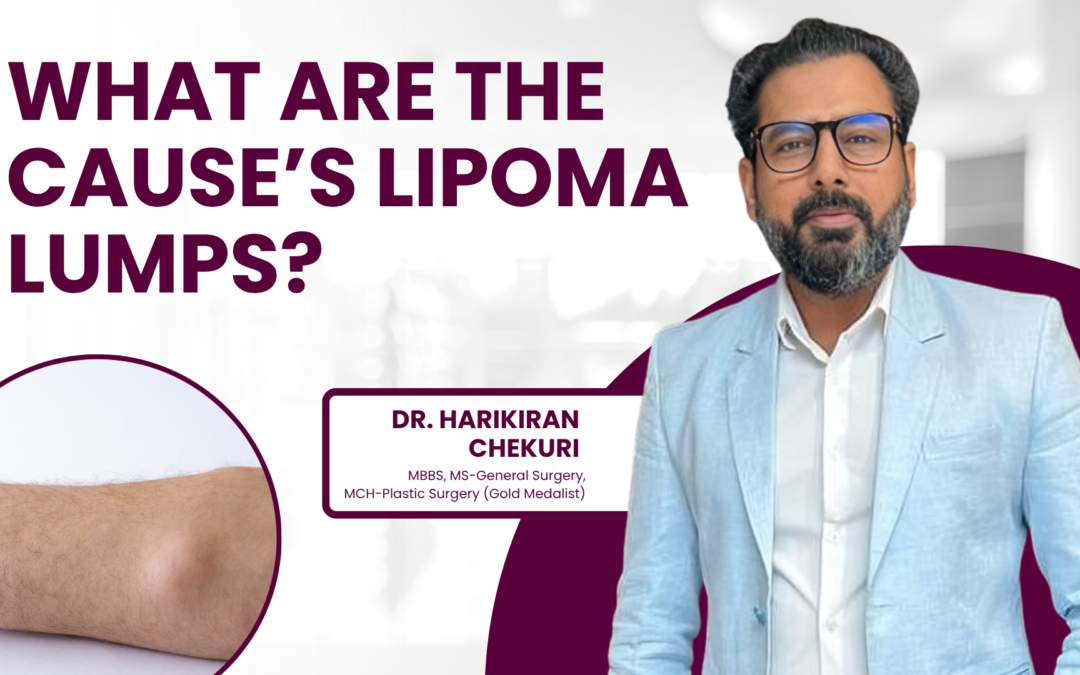What Are The Cause’s Lipoma Lumps?