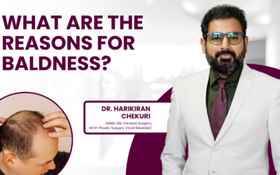 What Are The Reasons For Baldness?