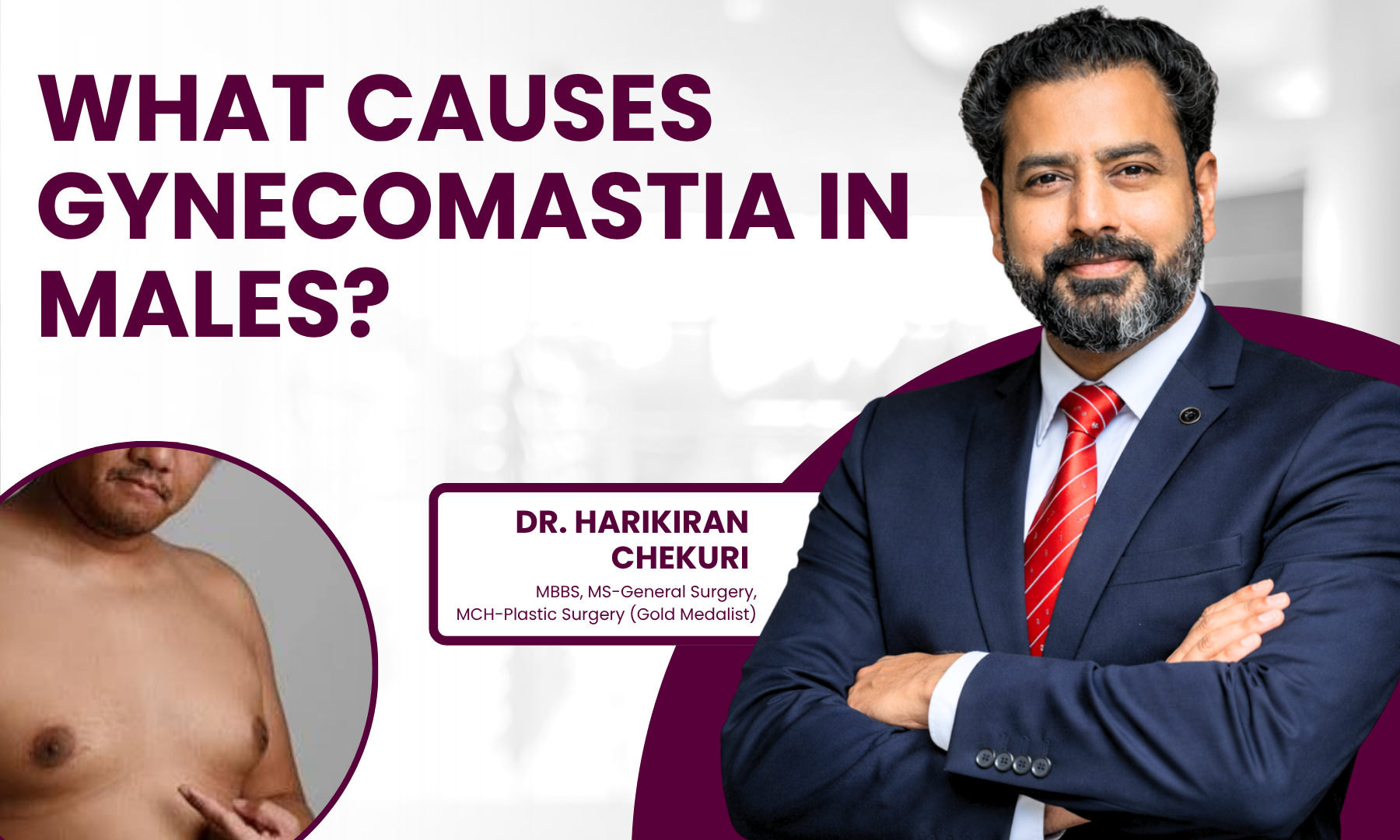 What Causes Gynecomastia in Males