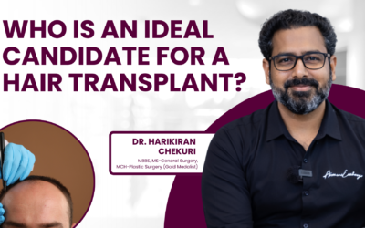Who is an Ideal Candidate for a Hair Transplant?