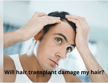 will hair transplant damage my hair