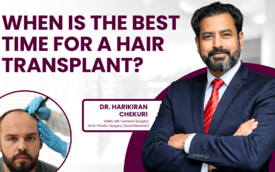 When is the best time for a hair transplant?