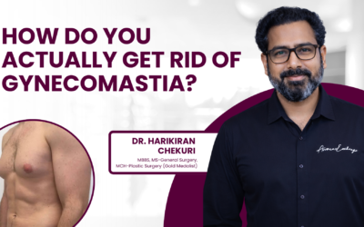 What Are the Benefits of Liposuction Surgery?
