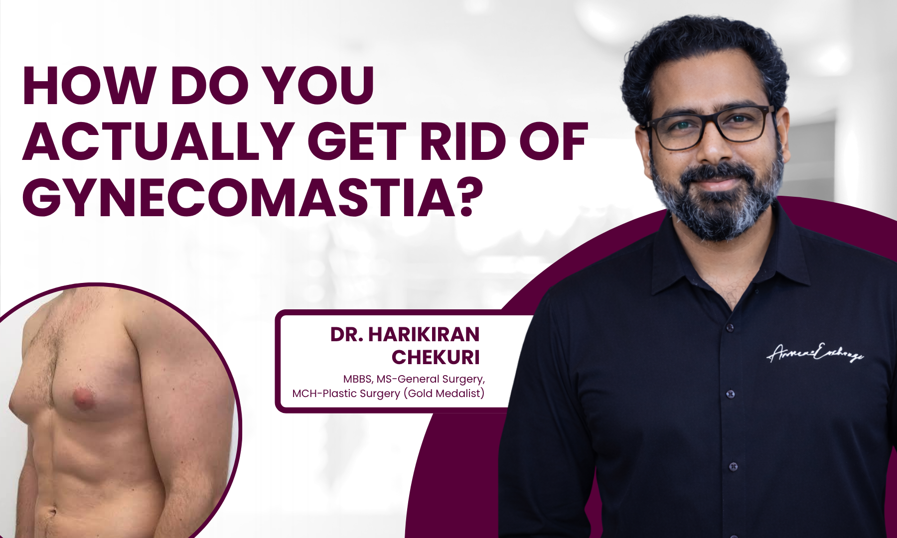 How Do You Actually Get Rid of Gynecomastia