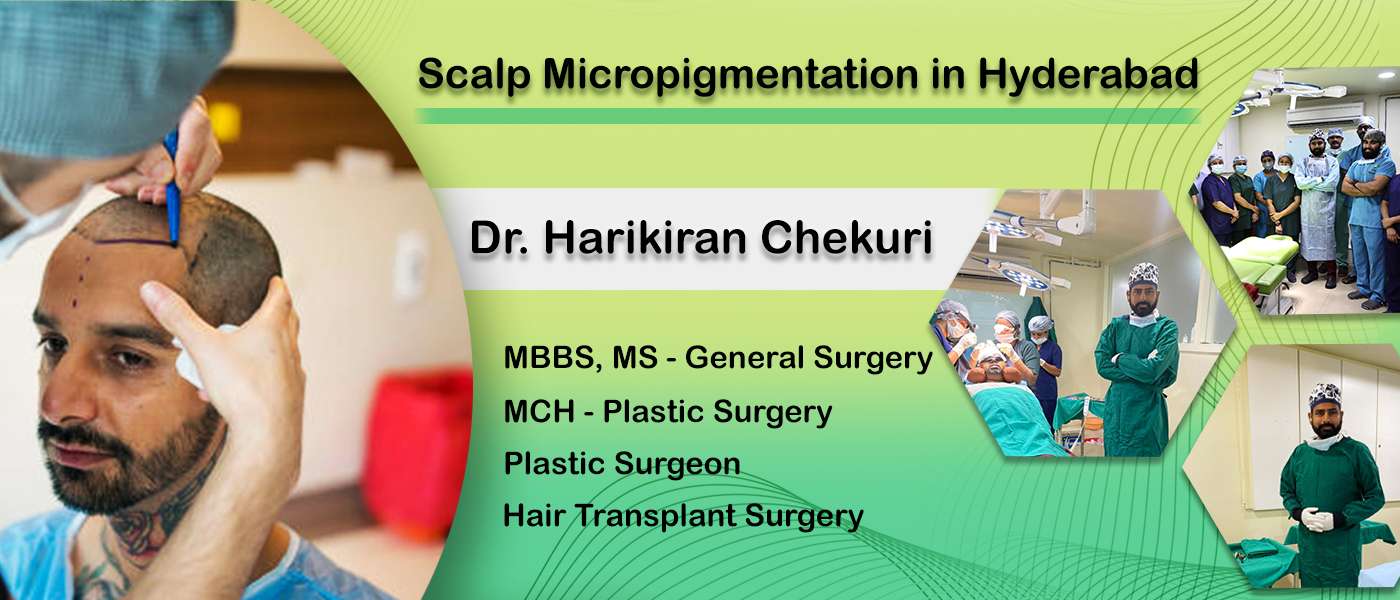 Scalp Micropigmentation in Hyderabad