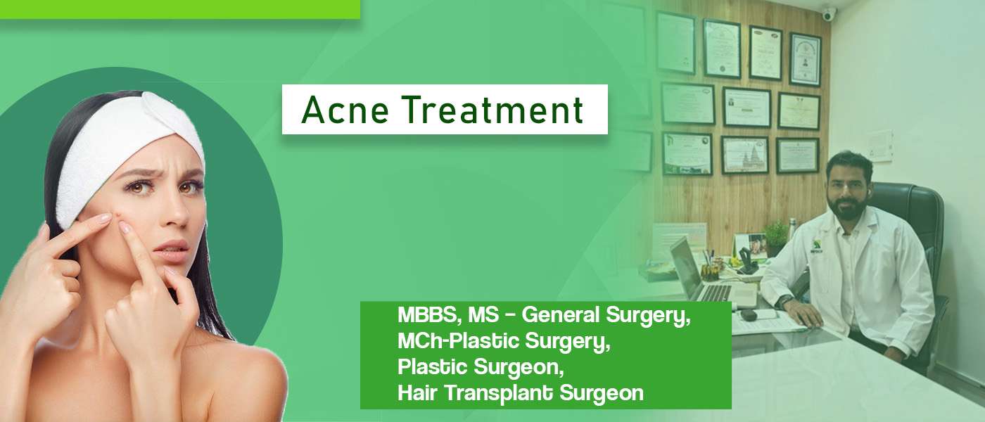 Acne Treatment in Hyderabad Acne Treatment Cost in Hyderabad