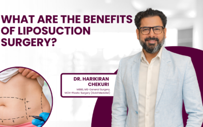 How Do You Actually Get Rid of Gynecomastia?