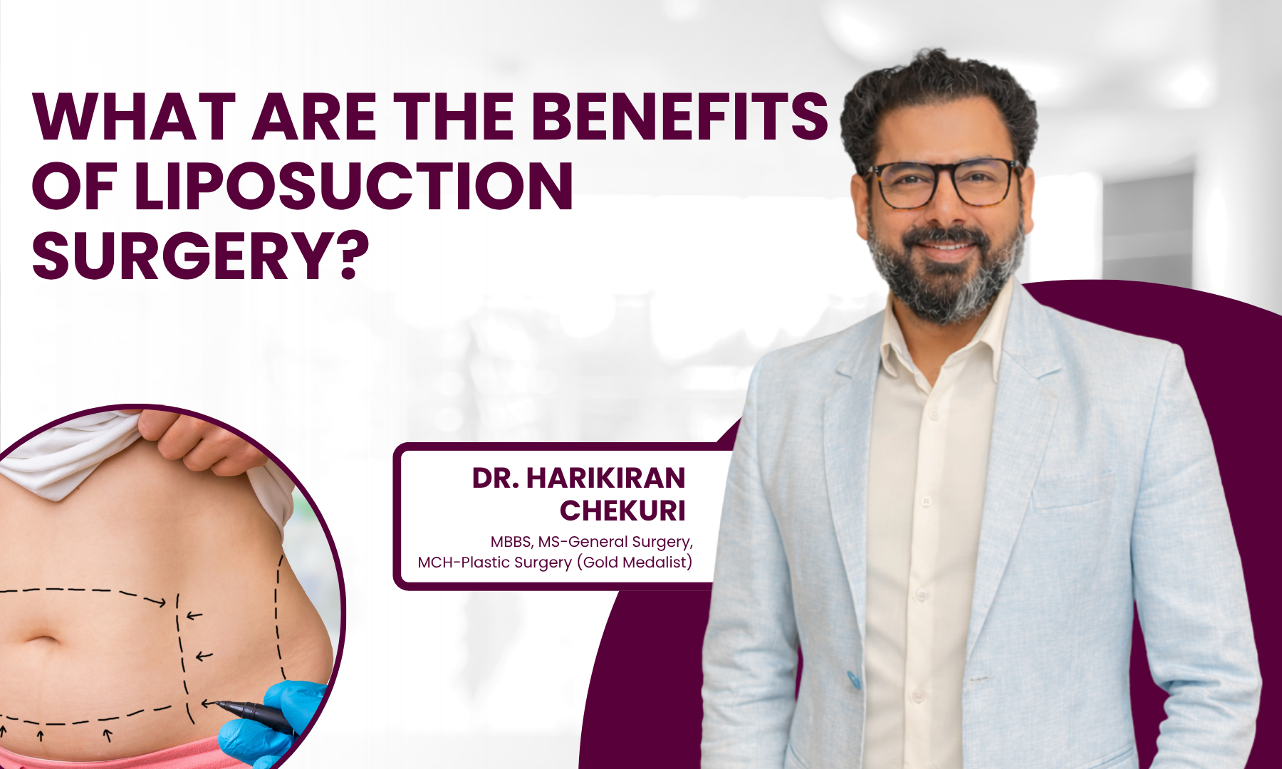 What Are the Benefits of Liposuction Surgery