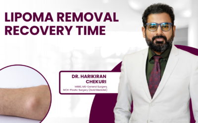 Lipoma removal recovery time