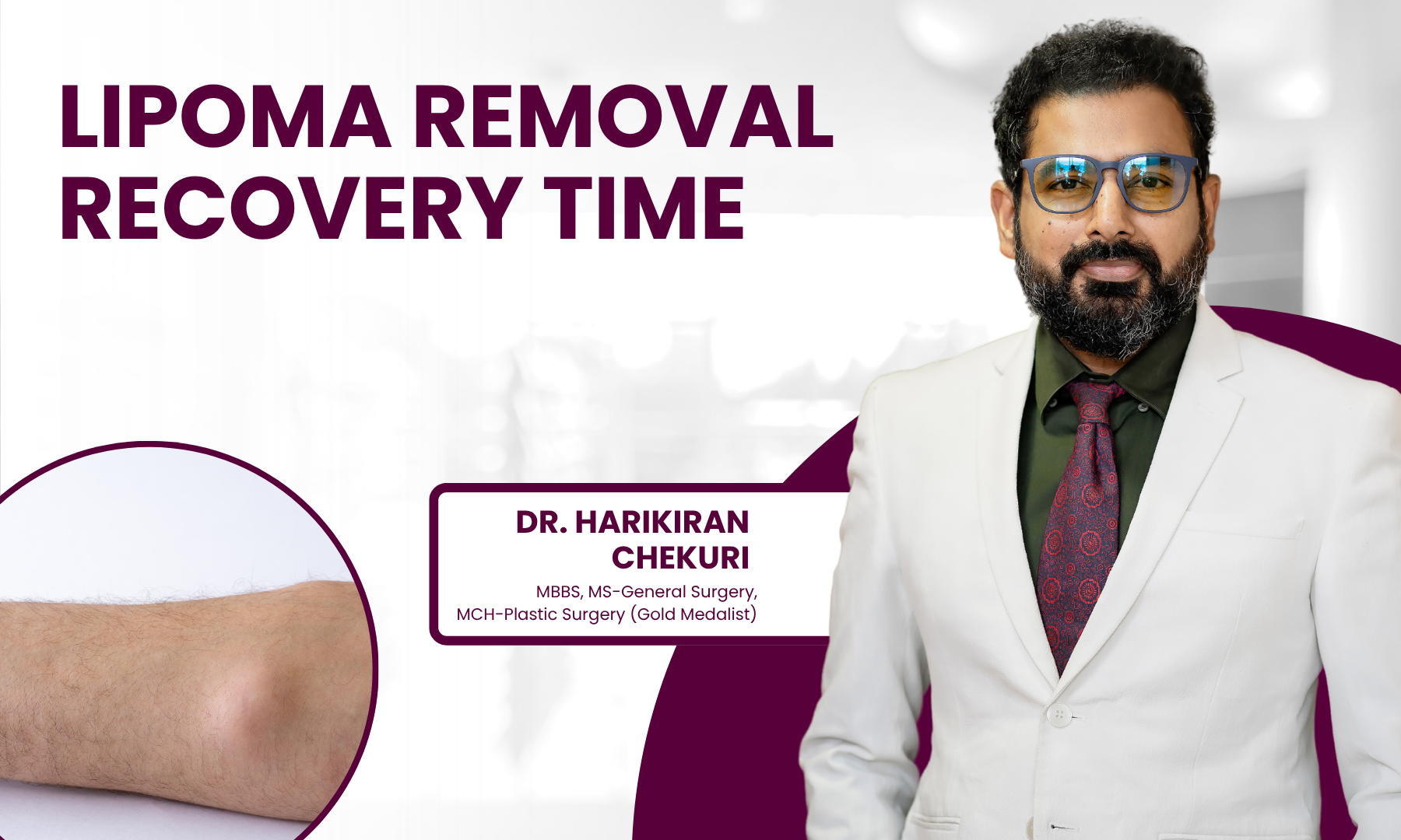 Lipoma Removal Recovery Time