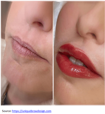 lip polishing before after