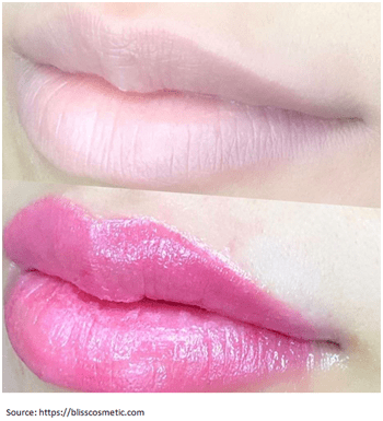 lip polishing before after1