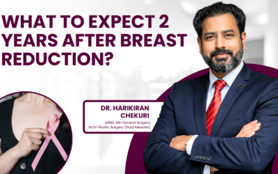 What to Expect 2 Years After Breast Reduction?