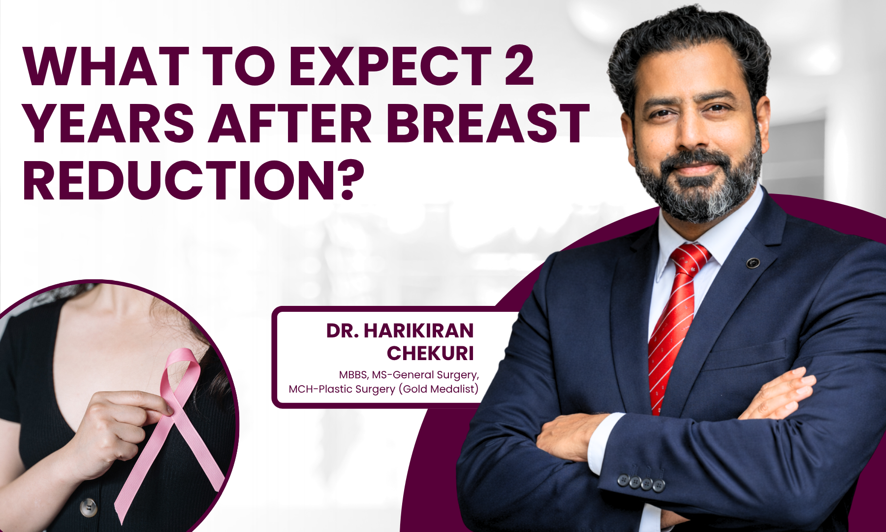 What to Expect 2 Years After Breast Reduction