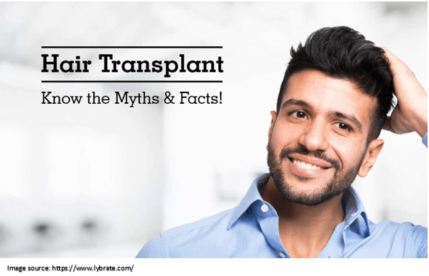 Myths of Hair Transplant | Dr. Harikiran
