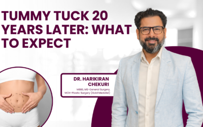 Tummy Tuck 20 Years Later: What to Expect and Consider